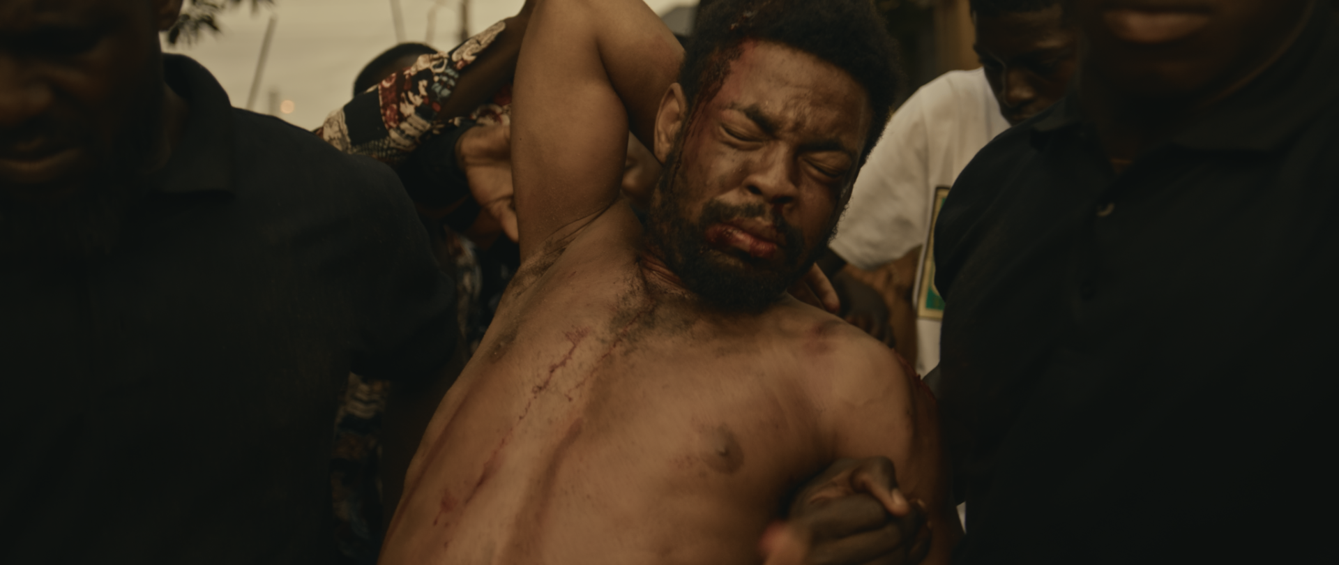 A wounded young man held up by the crowd